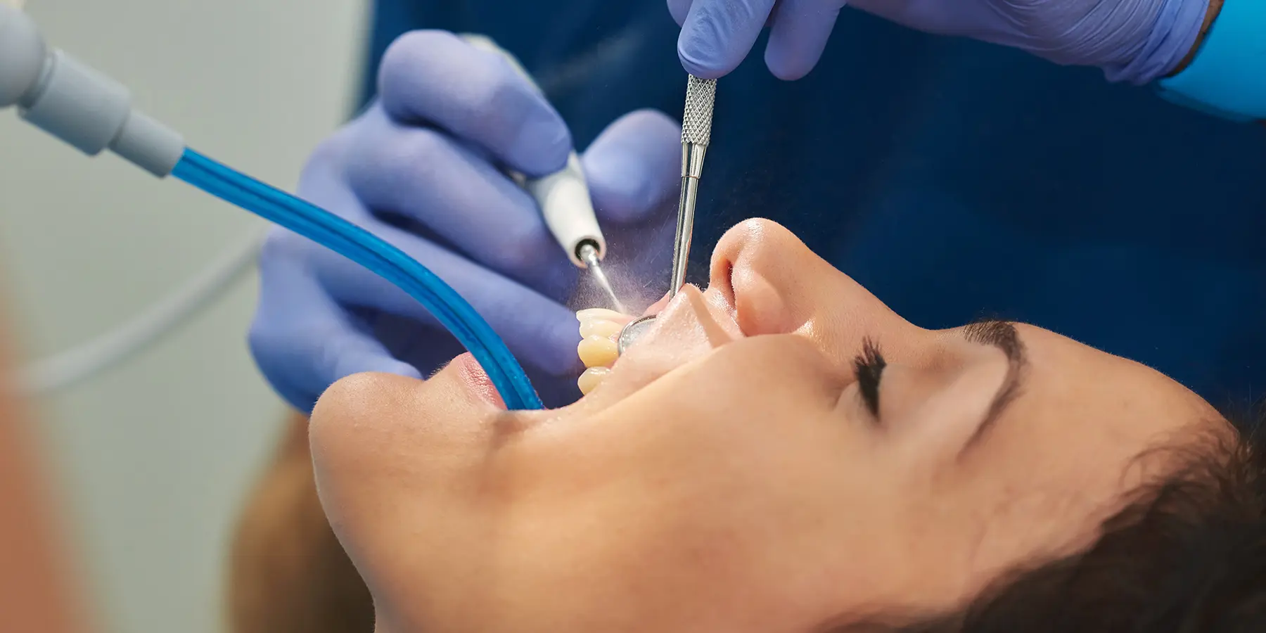 Visit Morris Dental Solutions for Dental Cleanings in Buffalo Grove, IL