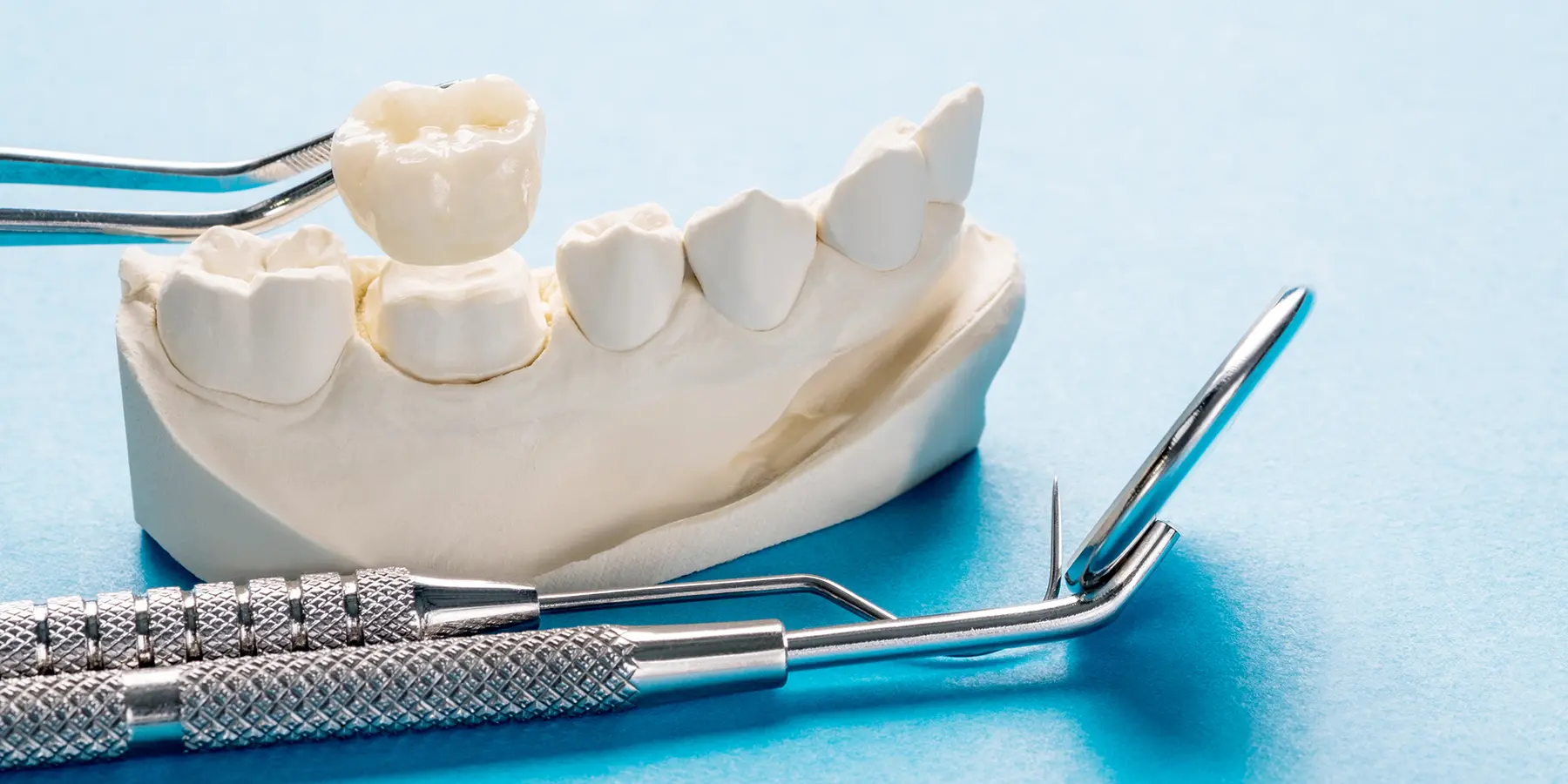 Your Guide to Fixed and Removable Prosthodontics