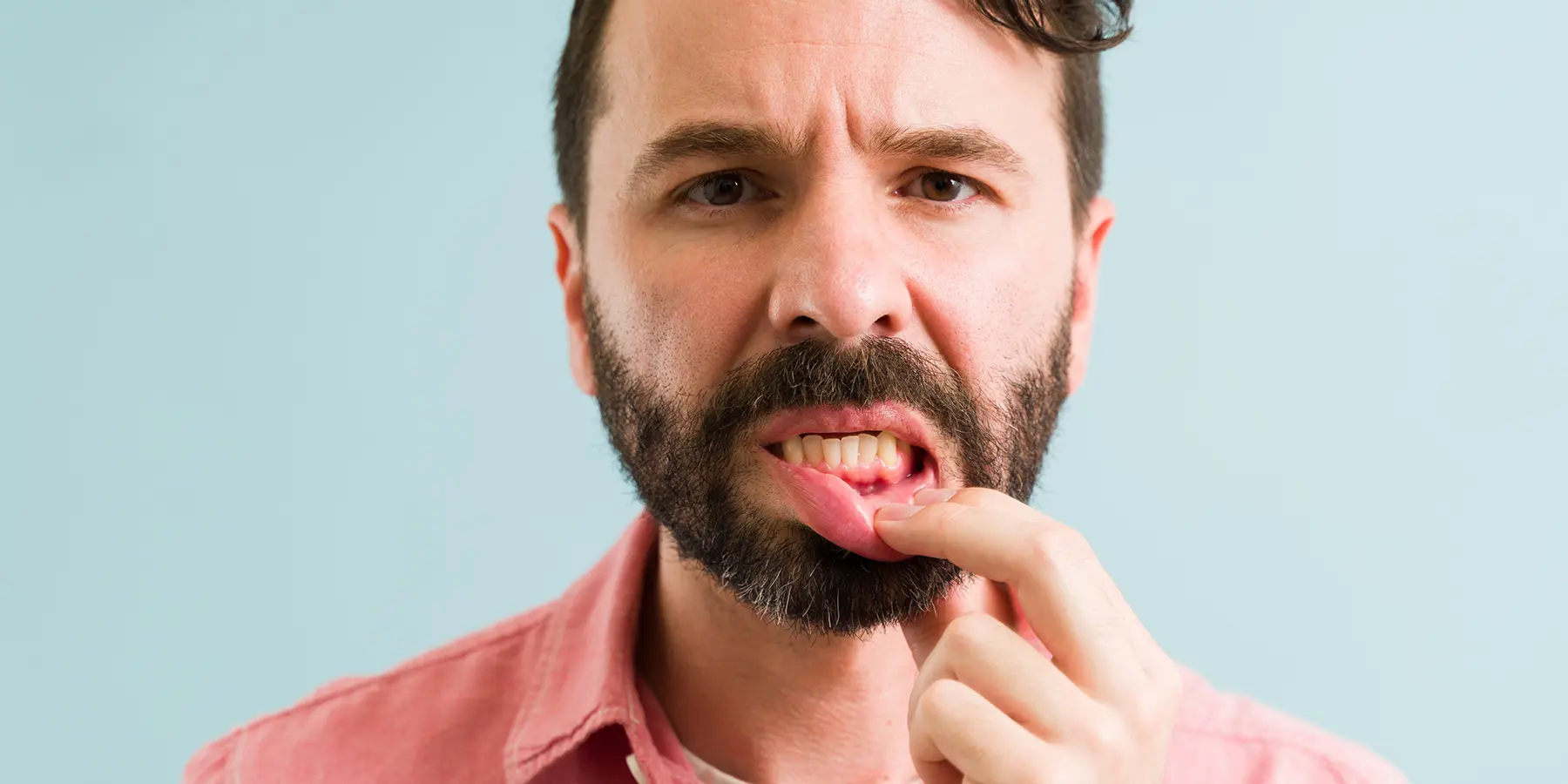 Is Periodontitis Reversible or Just Manageable? Expert Insights