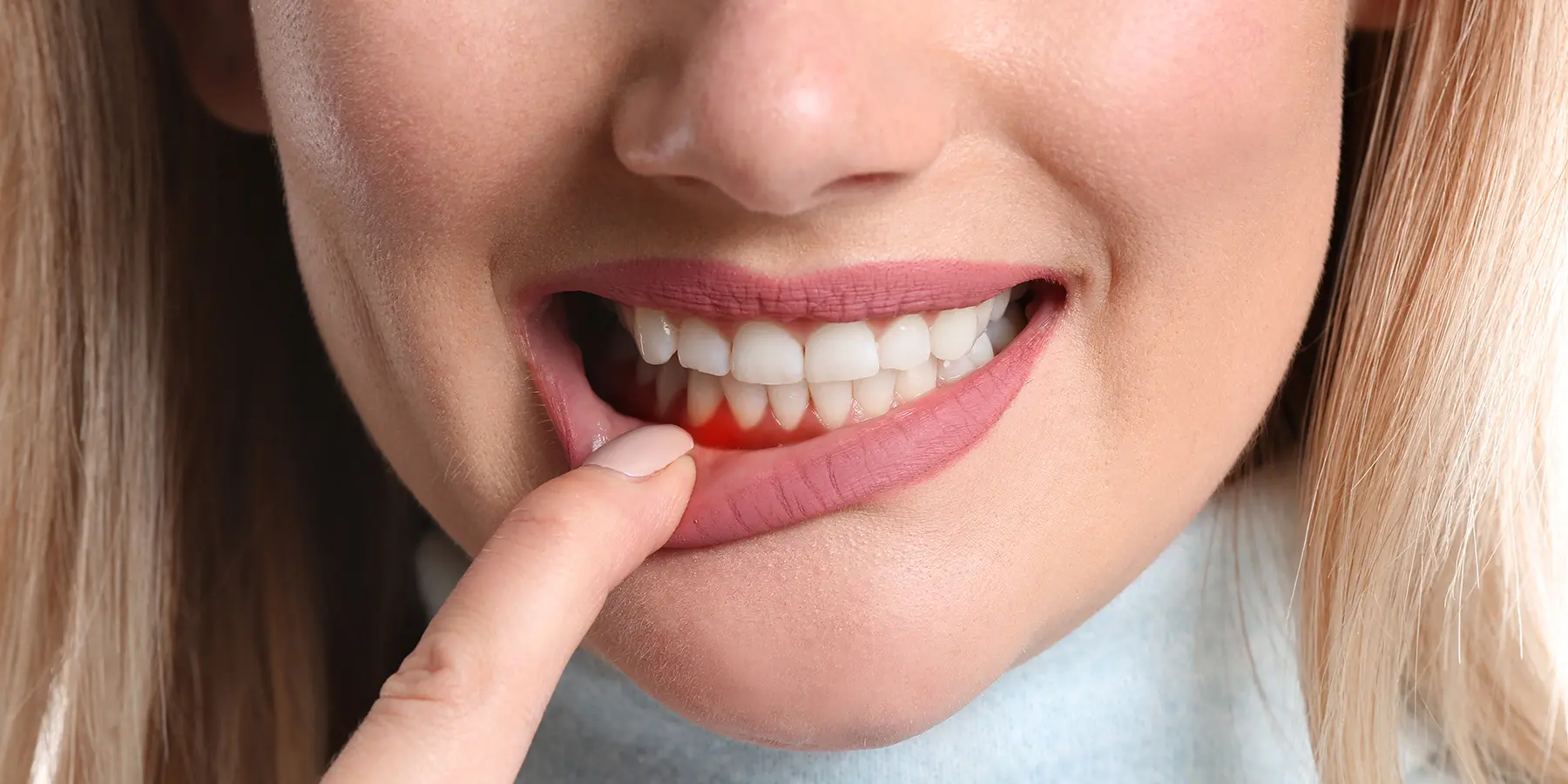 The Hidden Connection Between Dry Mouth and Periodontal Disease