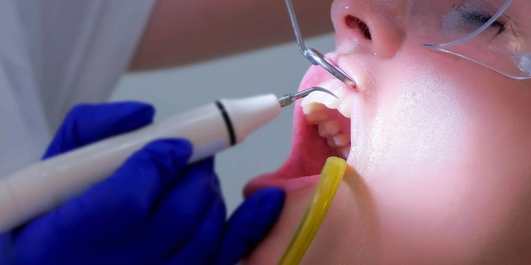 Dental Exam and Teeth Cleaning in Buffalo Grove, IL