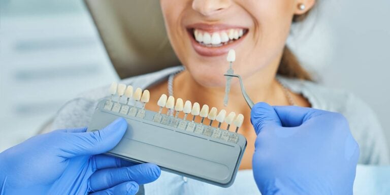 4 Types of Dental Crowns Explained